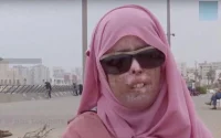 Le Xéroderma pigmentosum, l'allergie qui tue les enfants marocains (vidéo)