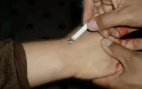 Agadir : un bébé torturé et brûlé avec des cigarettes par son père