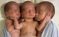 Maroc : une femme accouche de triplés partageant le même placenta