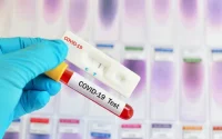 Espagne : des faux tests du Coronavirus vendus à des MRE
