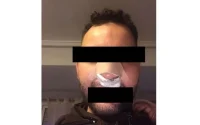 Agression raciste à Valence : Un Marocain demande des comptes et réclame justice