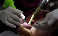 Soins dentaires moins chers au Maroc : les dentistes espagnols alertent