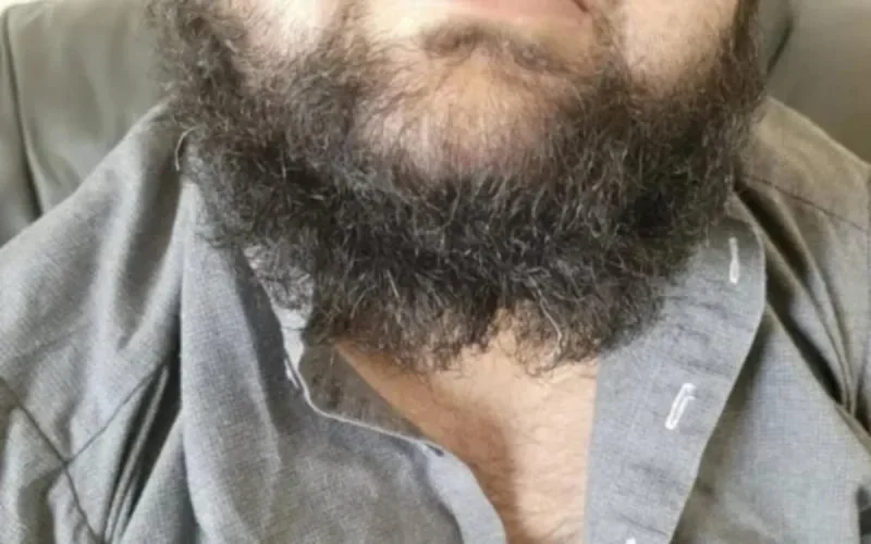 Canada : on a coupé la barbe à un homme parce que musulman