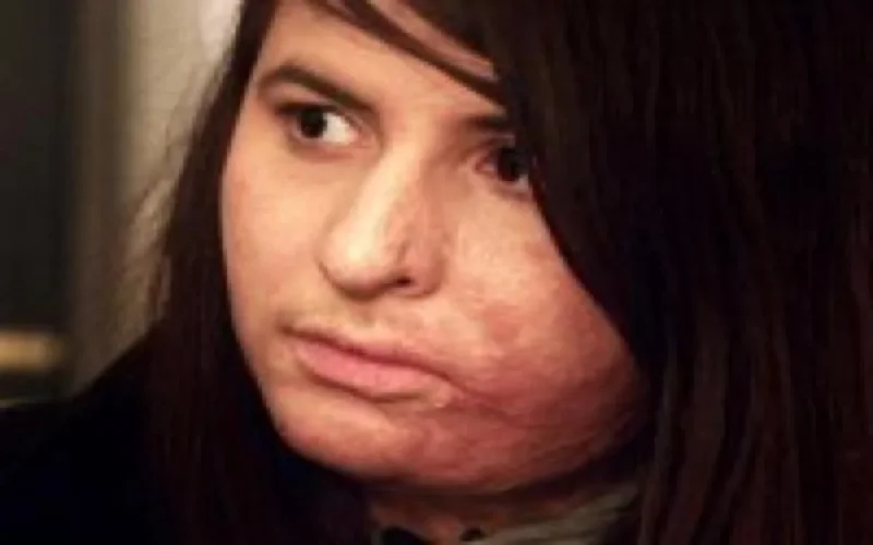 France : procès de l'agresseur de Chahrazad, brulée vive