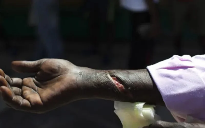 Melilla : des lames tranchantes pour empêcher le passage de clandestins