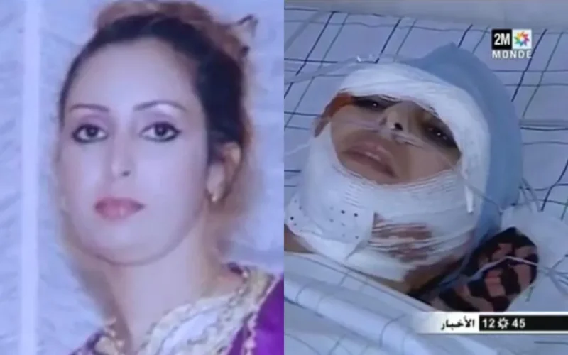 Une femme sauvagement agressée après avoir demandé le divorce (vidéo)