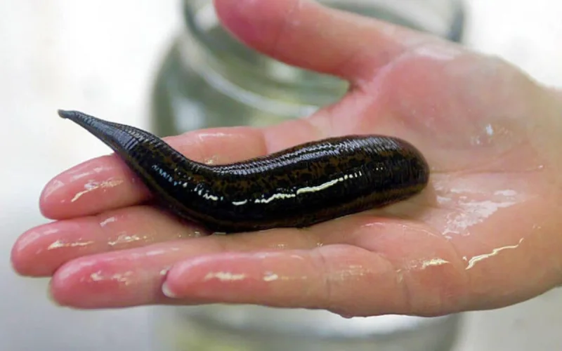 Maroc : une sangsue de six centimètres a été retirée de la gorge d'une fillette