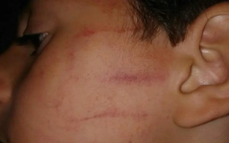 Tanger : une enseignante suspendue après une gifle à un élève (photo)