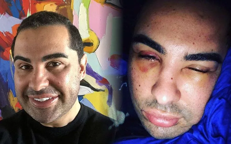 Doc Samad quitte le Maroc après une agression (photo)