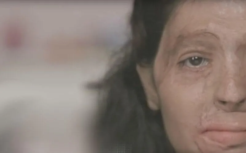 Maroc : la police dément des attaques à l'acide ciblant les femmes