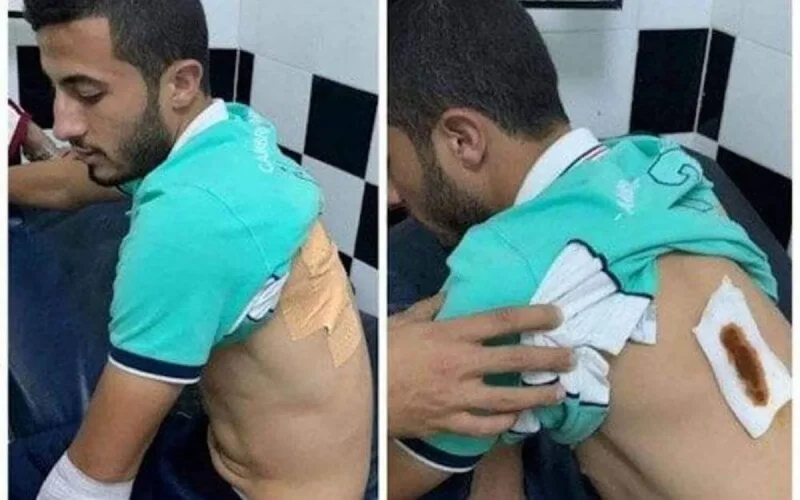 Maroc : un joueur violemment agressé à l'arme blanche