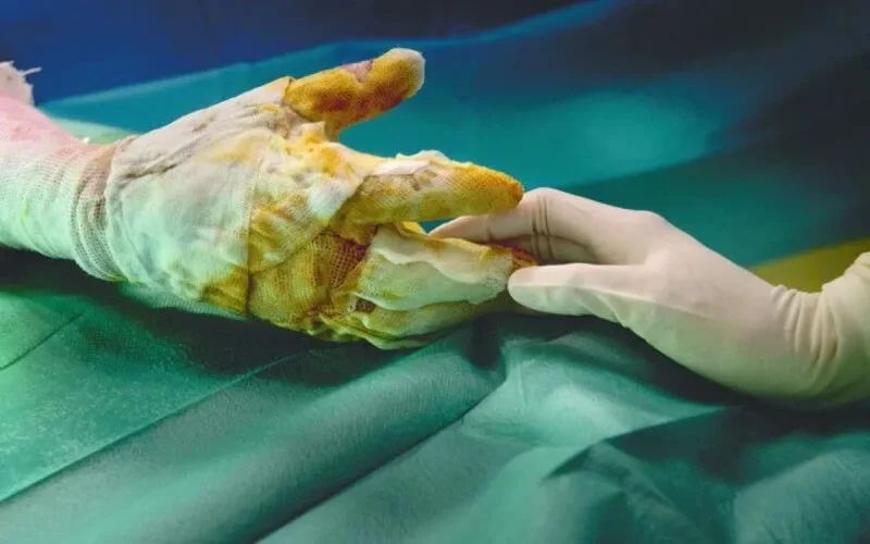 Marrakech : grave incendie dans une école coranique, un mort et un blessé