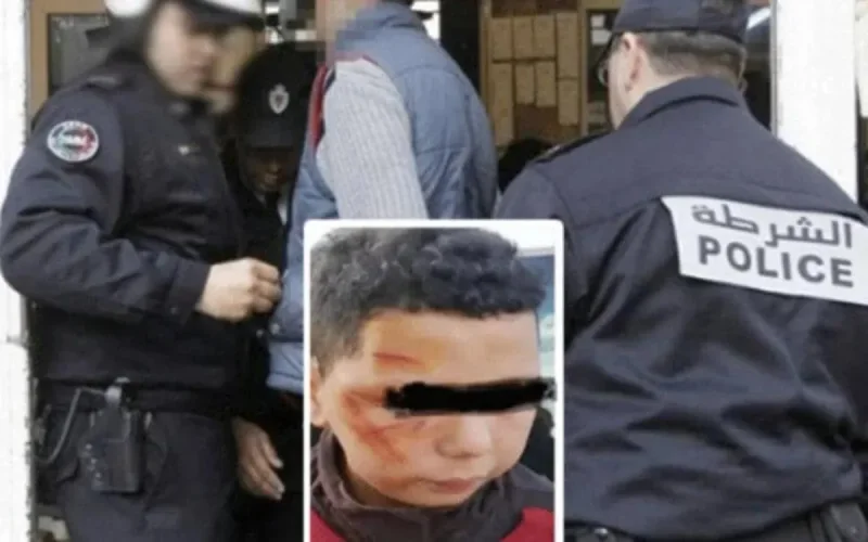 Un gardien de nuit interpellé pour avoir défiguré un enfant à Tanger