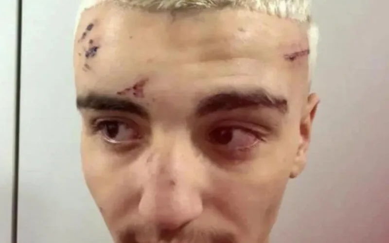 Belgique : la police tabasse le fils d'une figure connue du grand banditisme