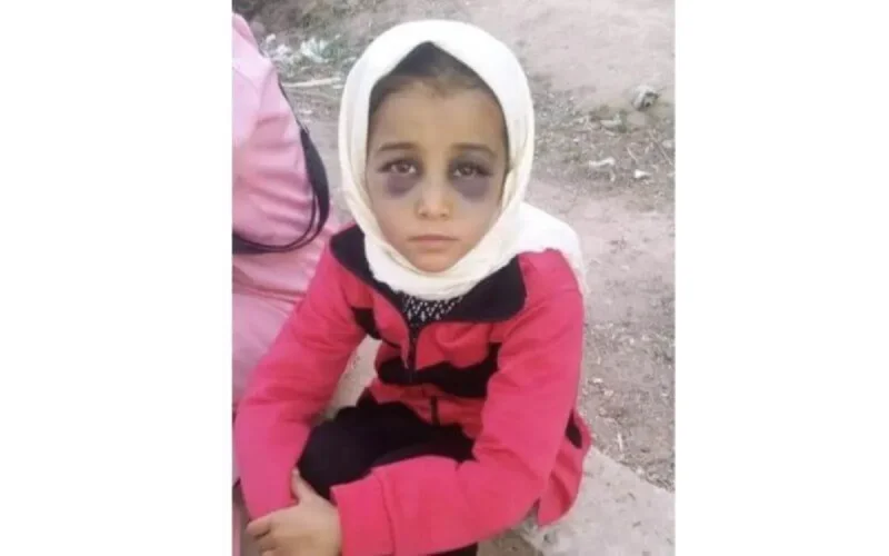 Taroudant : nouvelles révélations sur la fille tabassée à l'école