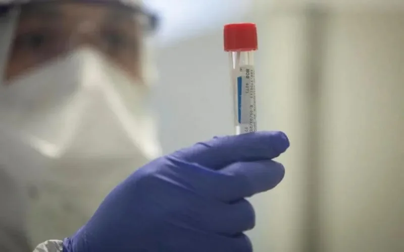  Le Maroc a acheté 100 000 tests de dépistage à la Corée du sud (démenti)