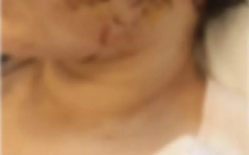 Molenbeek : une femme défigurée par son ex-mari