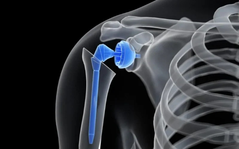 Une première médicale à Fqih Ben Salah