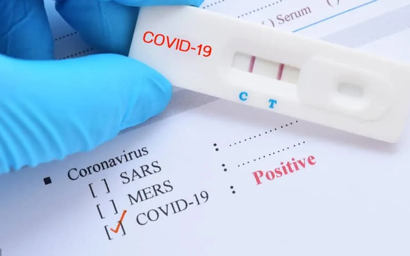 Coronavirus au Maroc : des tests rapides dans les pharmacies