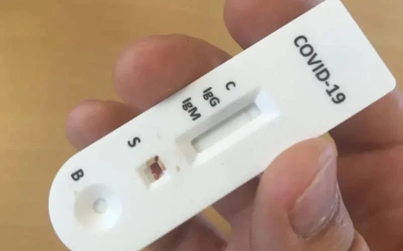 Le Maroc introduit les tests Covid antigéniques rapides