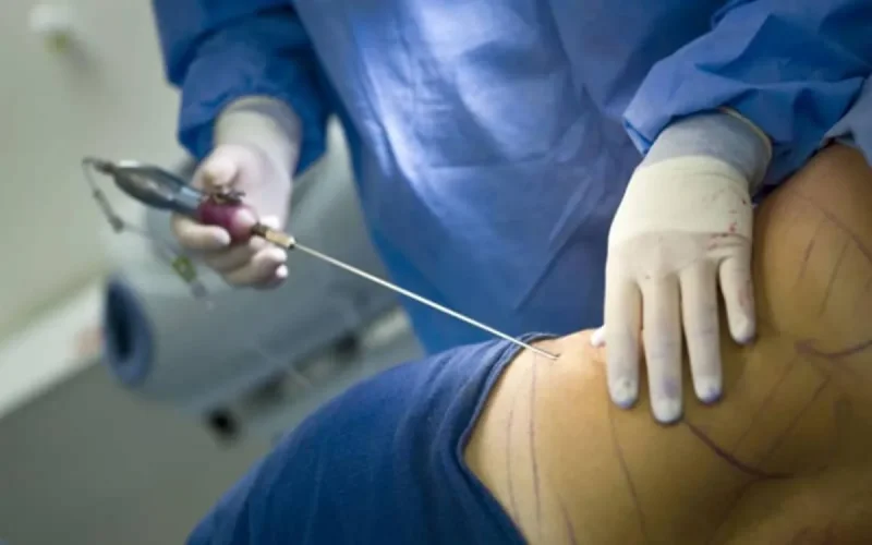 Le tourisme médical : une mine d'or pour le Maroc