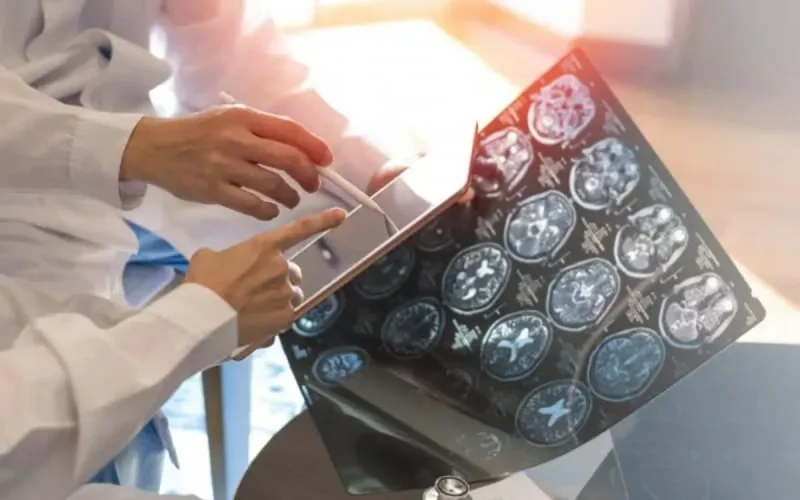 Le Covid-19 entraîne des dommages au cerveau (étude)