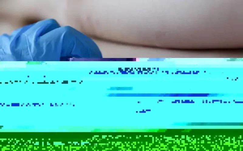 Variole du singe : trois cas suspects en cours d'examen au Maroc