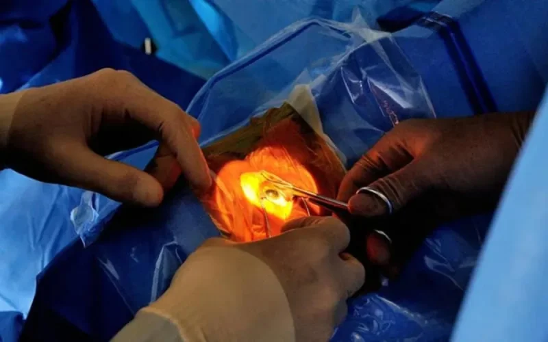 Un Marocain perd la vue à cause d'un faux médecin