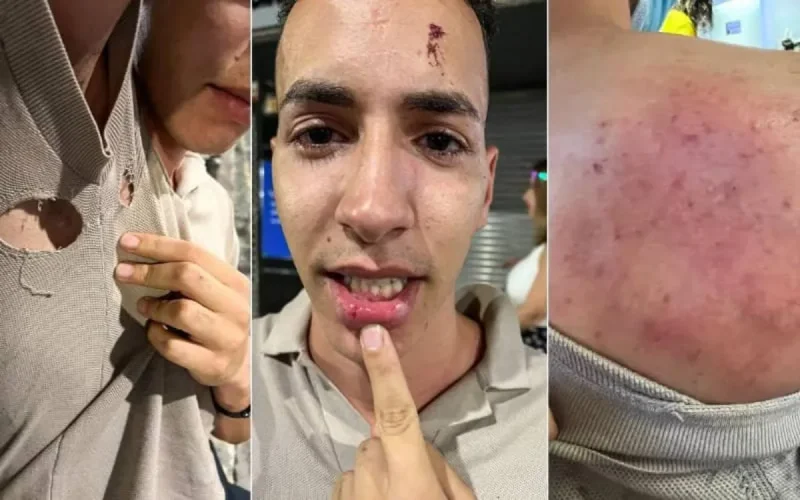 Un Marocain victime d'une agression raciste en Espagne