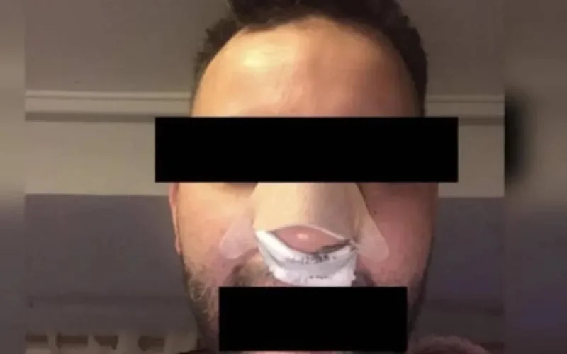 Un Marocain victime d'une agression raciste en Espagne 