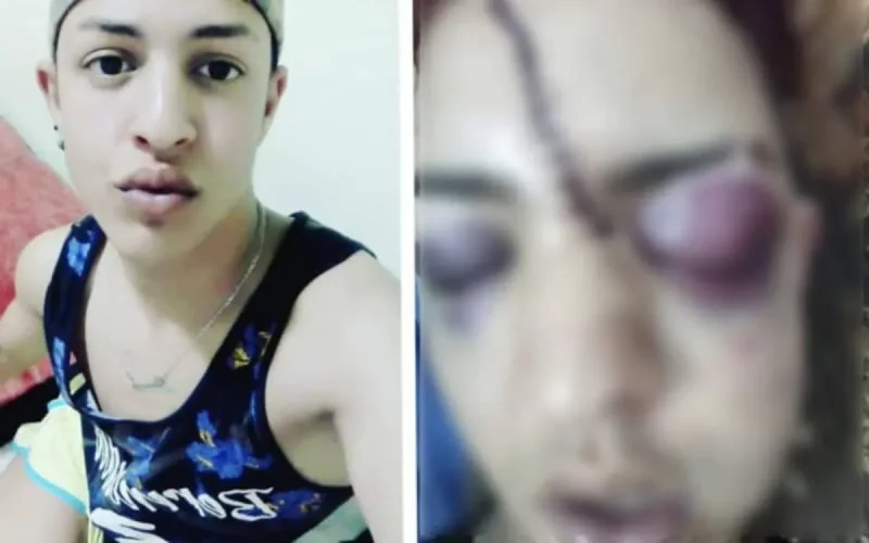 Un MRE d'Espagne victime d'une agression homophobe à Kénitra