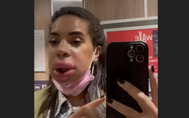 Marwa Merazka frôle la catastrophe après une intervention esthétique