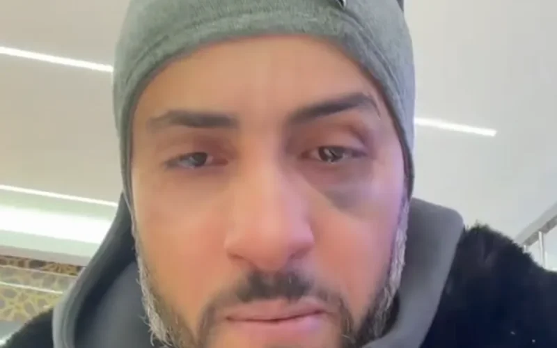 Bruxelles : « Ouvre ou on tue ta famille », le calvaire d'un bijoutier frappé à coups de Kalachnikov