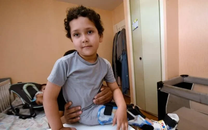 Toulouse : né sans tibias, le combat de Farouk pour avoir la chance de marcher