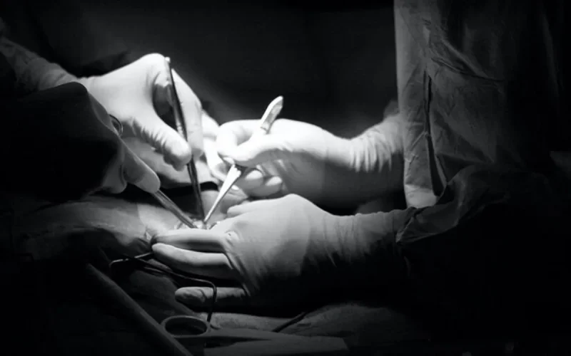 Val-d'Oise : un praticien en circoncision interpelé pour pratique illégale