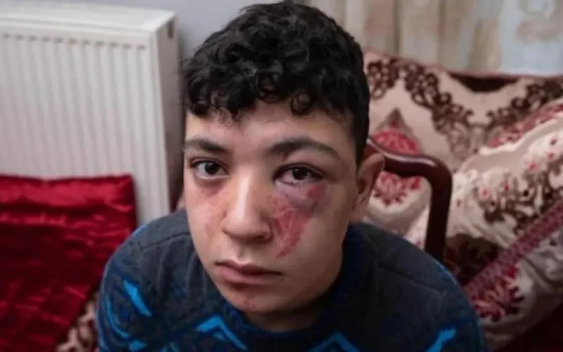 Violences policières sur Mounaim : la justice classe l'affaire