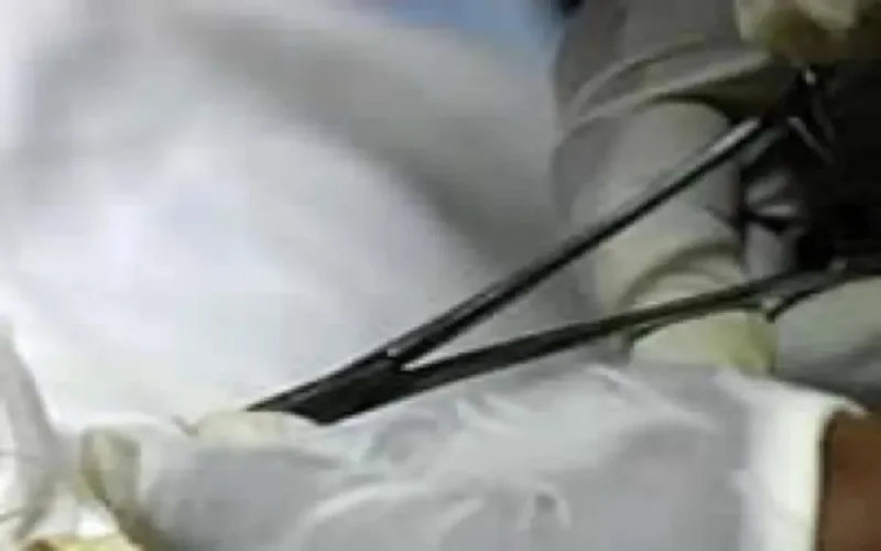 Circoncision : Des bistouris et des hommes