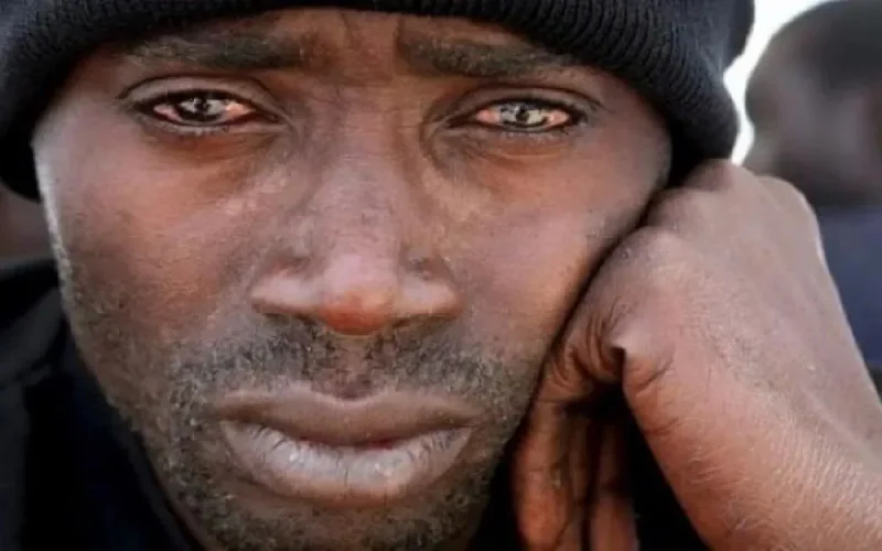 Pour certains députés marocains, les immigrants africains sont vecteurs de "maladies contagieuses et dangereuses"