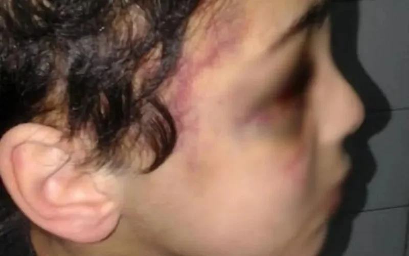 Un garçon de cinq ans violé et torturé par sa mère adoptive