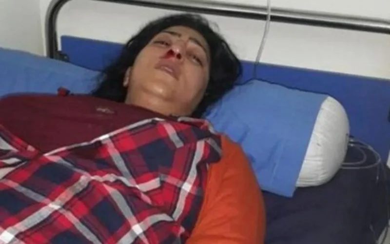 Dounia Boutazout : fracture au nez après une agression (photos)