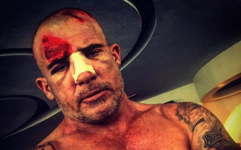Dominic Purcell se blesse lors du tournage de Prison Break au Maroc (photo)