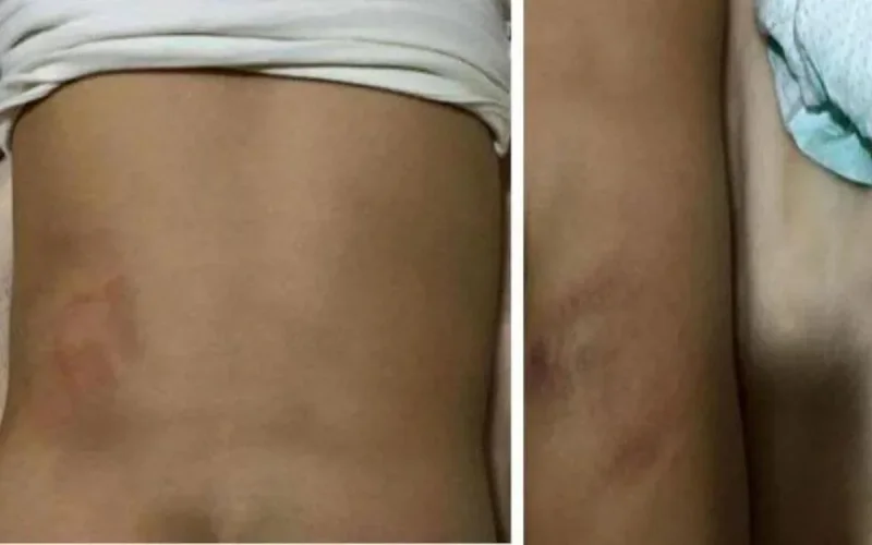 Espagne : une Marocaine jugée pour avoir « corrigé » ses enfants avec un câble électrique