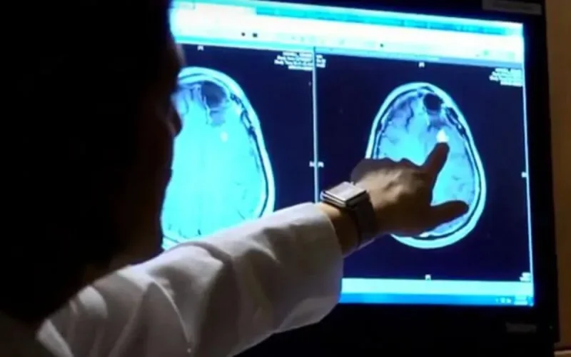 Un Marocain met au point un traitement révolutionnaire contre le Cancer 