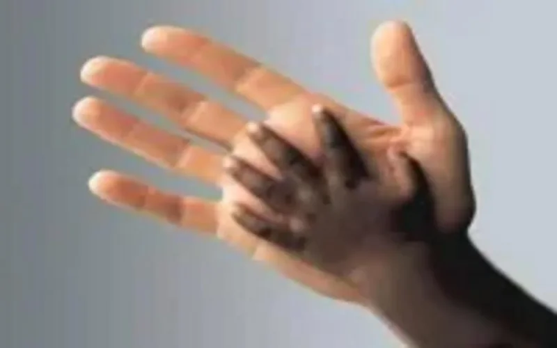 La violence raciste redouble en France