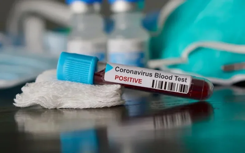 Covid-19 : un joueur professionnel contaminé