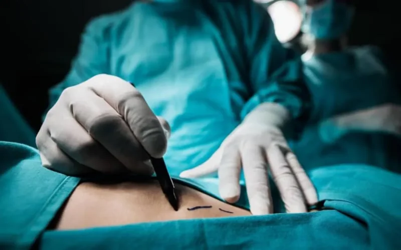 Des hommes politiques marocains ont recours à la chirurgie esthétique
