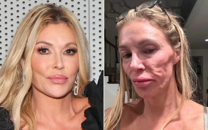 Une star américaine « défigurée » après un tournage au Maroc