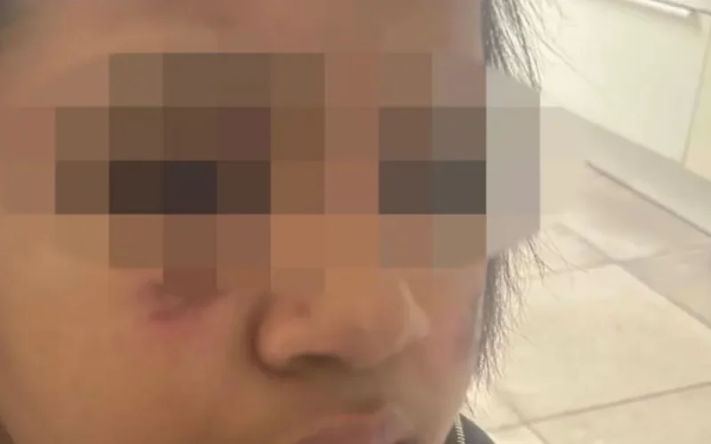Molenbeek : Camilia, 14 ans, rouée de coups et brûlée au visage par huit individus