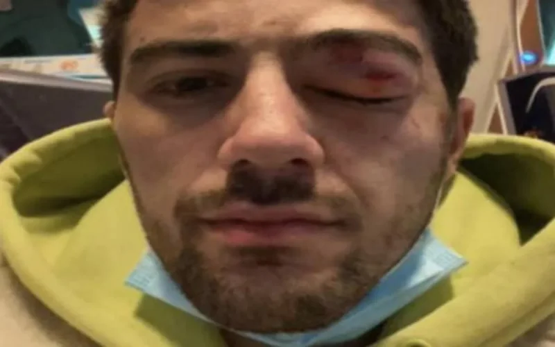 Un acteur marocain violemment agressé à Paris