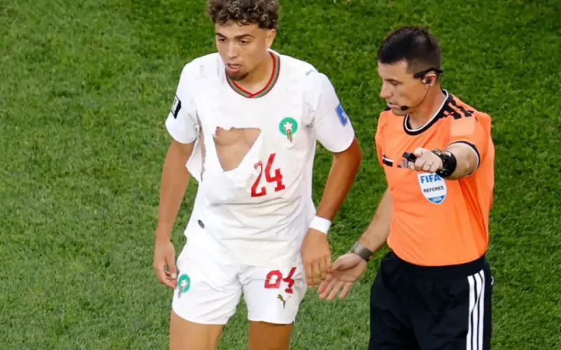 Maroc-Écosse : Le maillot déchiré de Neil El Aynaoui embarrasse Puma